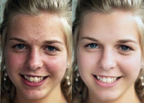 Photoshop使用通道法给满脸雀斑的女人磨皮