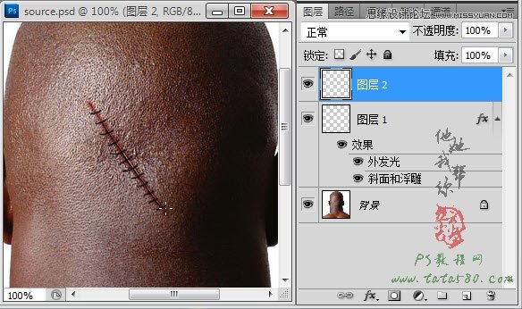 Photoshop合成人物缝合的伤口效果教程,PS教程,素材中国