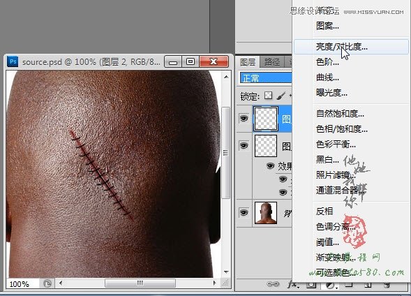 Photoshop合成人物缝合的伤口效果教程,PS教程,素材中国