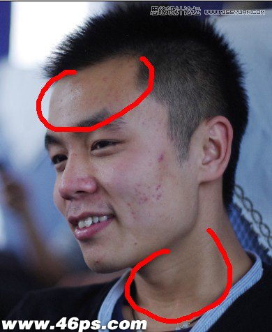 Photoshop详细解析男人脸部去痘美容教程-设计